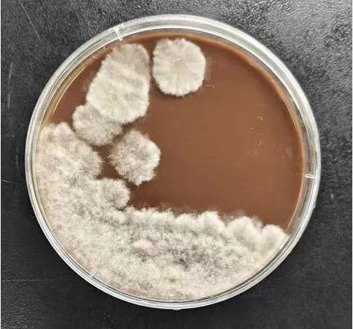 尖端赛多孢子菌所致眼部感染一例及其生物菌种分析