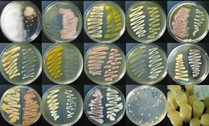 微生物菌种与生物菌种 探秘微观世界的关键角色
